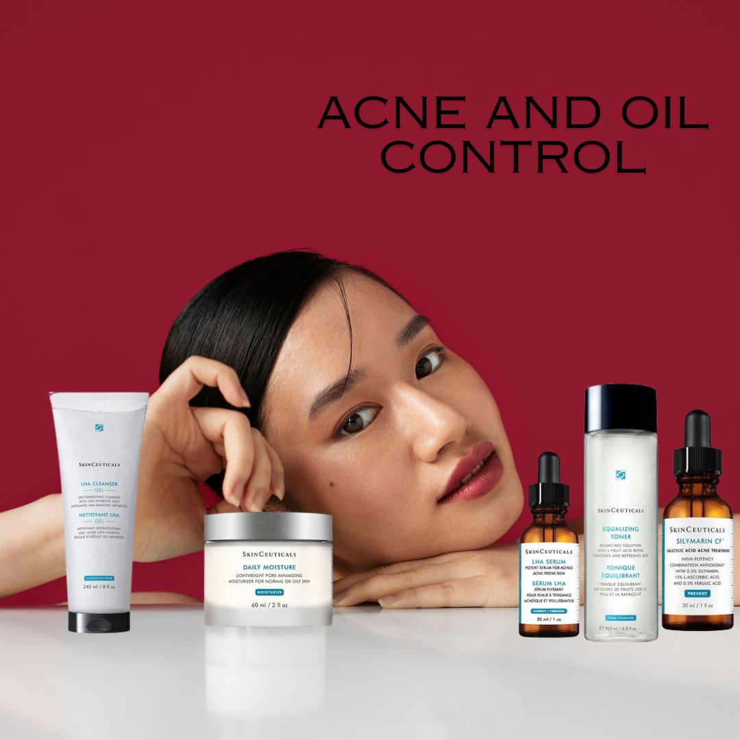 Oil Under Control – For When Your Skin’s Always One Step from Breaking Out Beacon Dermatology Skincare