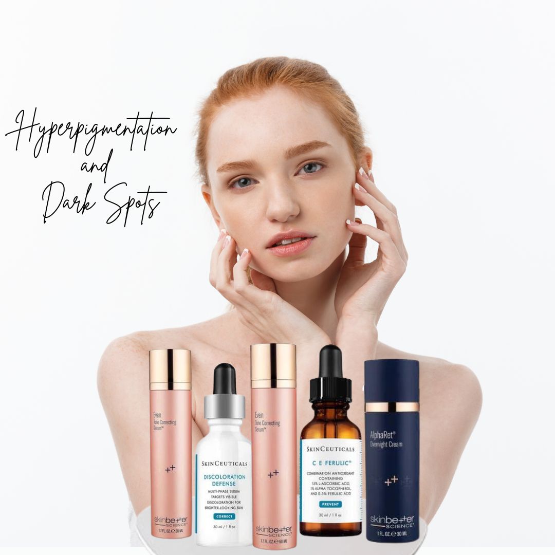 Ultimate Hyperpigmentation and Dark Spots Beacon Dermatology Skincare